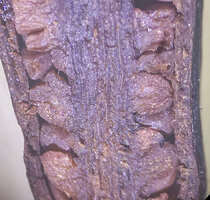 Cercestis blancii, female flowers reduced to one unilocular ovary with a single basal anatropous ovule 